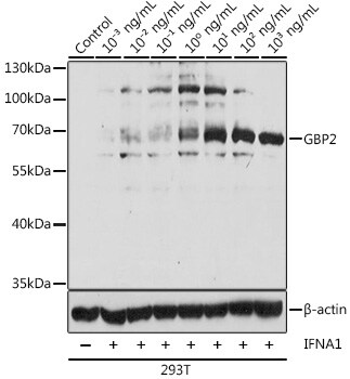 GBP2 Antibody