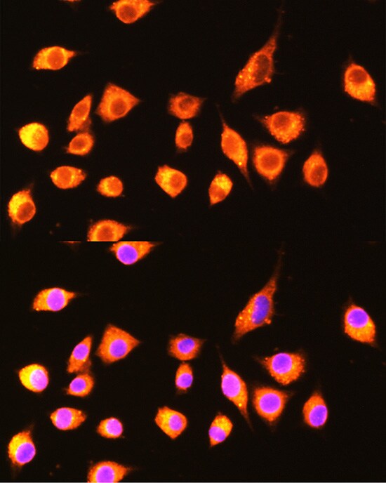 GBP2 Antibody