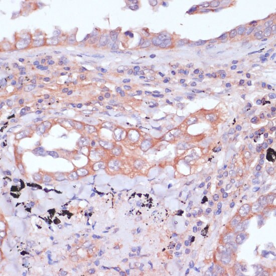 RPL32 Antibody