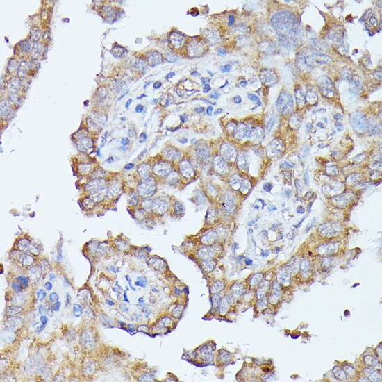 Histidase Antibody