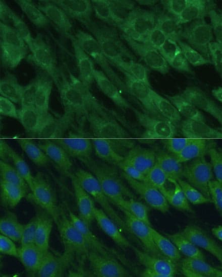 Histidase Antibody