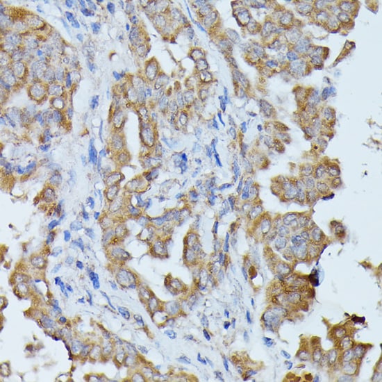 Histidase Antibody