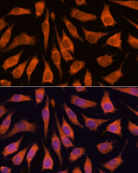 GOLPH3 Antibody