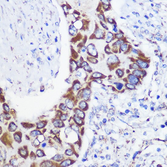 MTMR9 Antibody