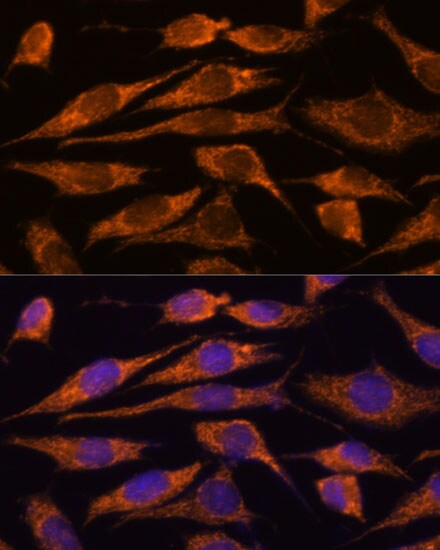 MTMR9 Antibody