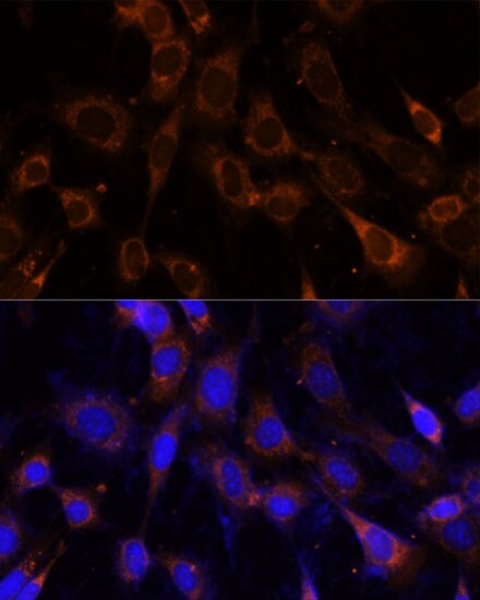 VPS25 Antibody