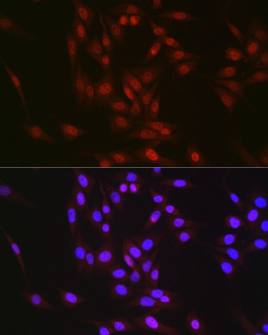 RBM14 Antibody