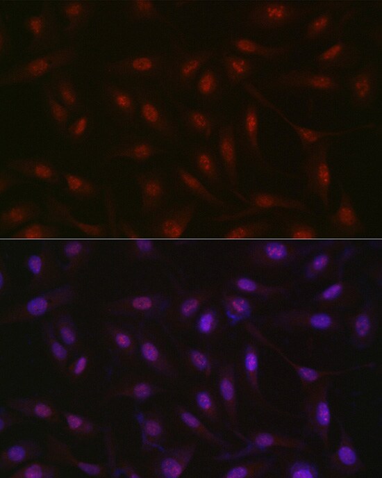 RBM14 Antibody