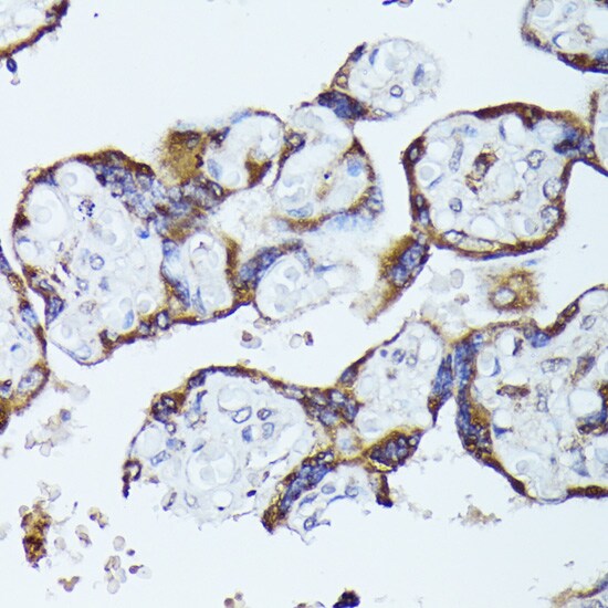 CKAP1 Antibody