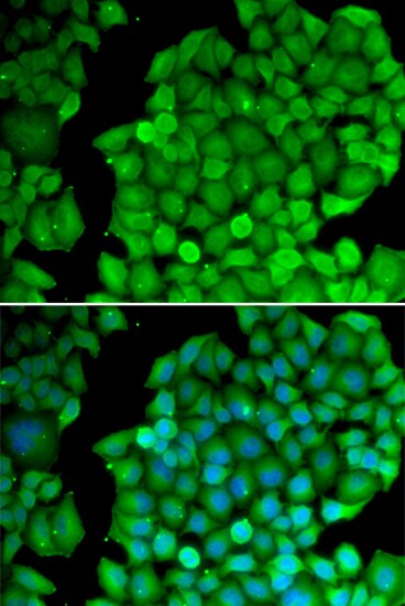 Cyclin D2 Antibody