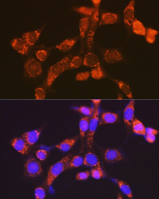 NDUFV1 Antibody