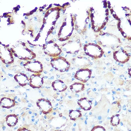 NDUFV1 Antibody