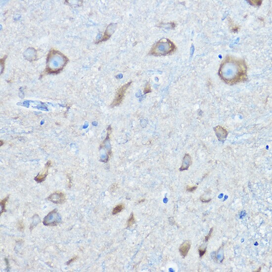 Seryl tRNA synthetase Antibody