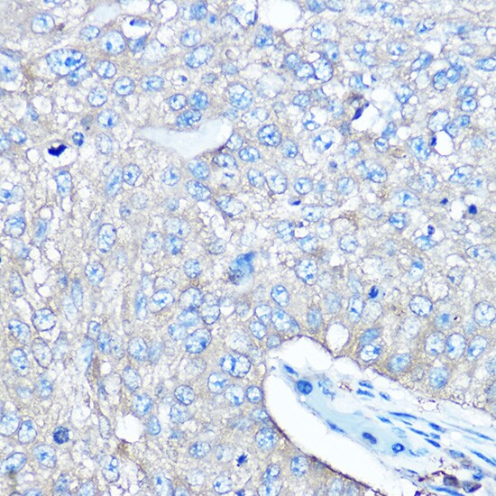 Seryl tRNA synthetase Antibody