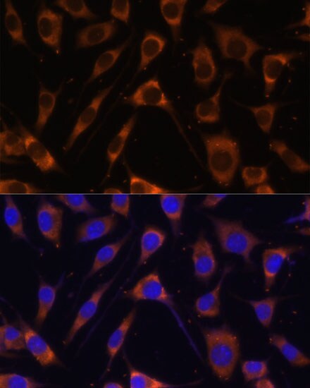 Laminin beta 1 Antibody
