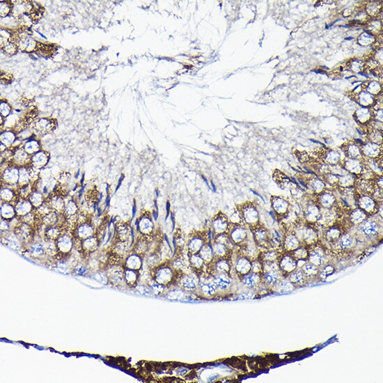 TCP1 alpha Antibody
