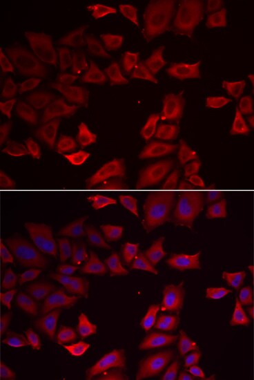 SEPHS1 Antibody