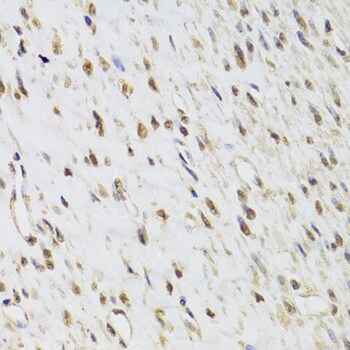 SEPHS1 Antibody