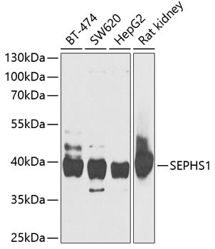SEPHS1 Antibody