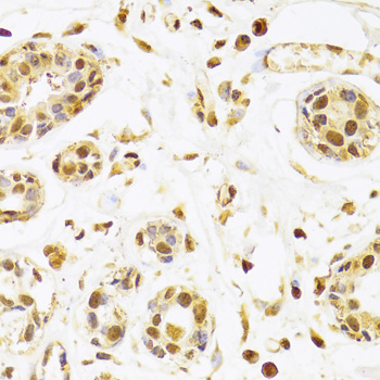 SEPHS1 Antibody