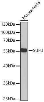 Suppressor of Fused Antibody