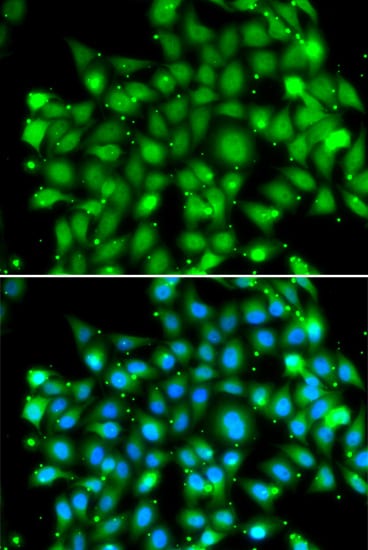 Suppressor of Fused Antibody