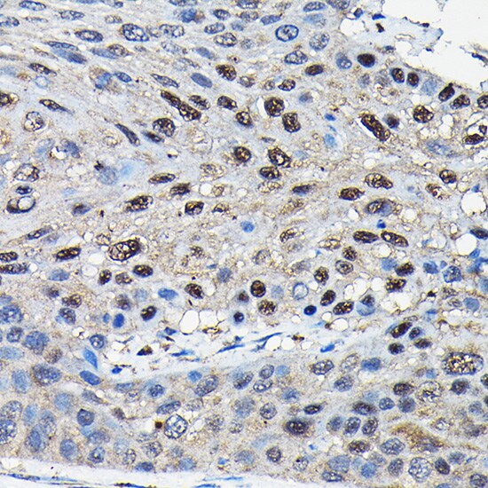 Suppressor of Fused Antibody