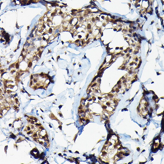 Suppressor of Fused Antibody