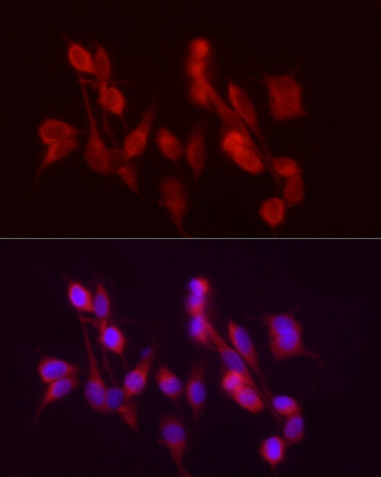 alcohol dehydrogenase 5 Antibody