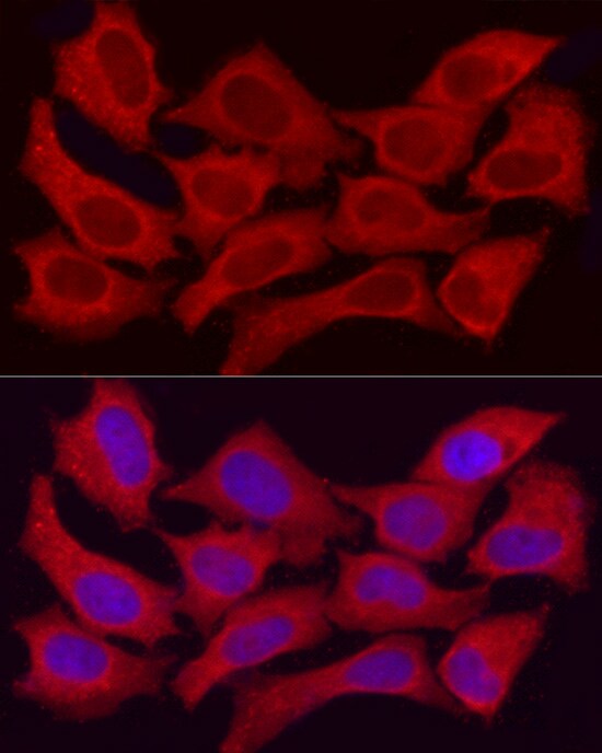 alcohol dehydrogenase 5 Antibody