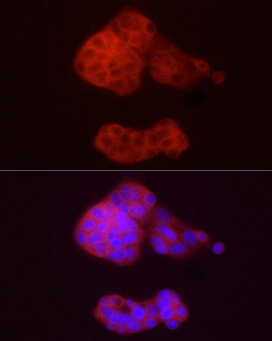 alcohol dehydrogenase 5 Antibody