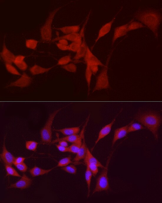 alcohol dehydrogenase 5 Antibody