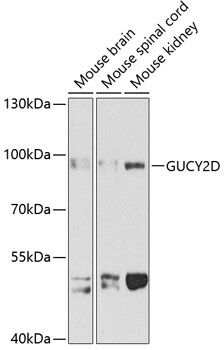 GUCY2D Antibody