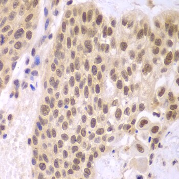 CKII alpha prime polypeptide Antibody