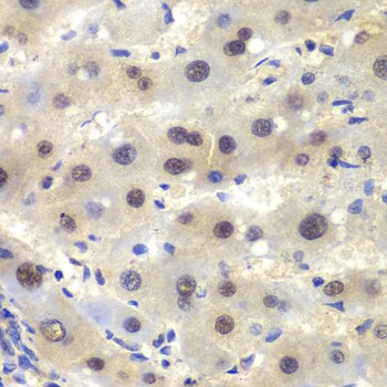 CKII alpha prime polypeptide Antibody