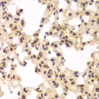 CKII alpha prime polypeptide Antibody