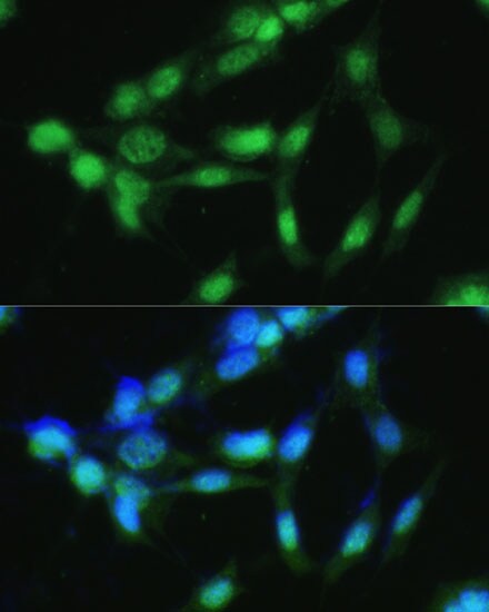 CKII alpha prime polypeptide Antibody