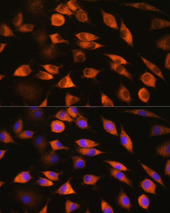 CYP51A1 Antibody