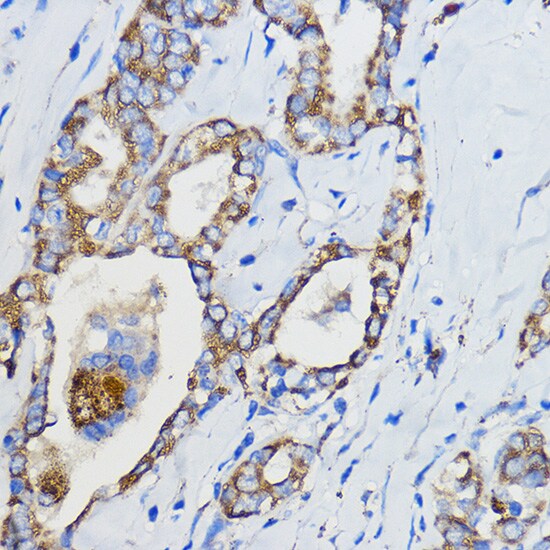 CYP51A1 Antibody