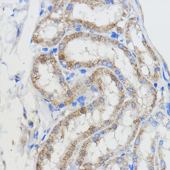 CYP51A1 Antibody