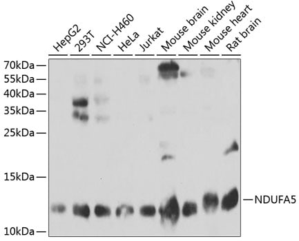 NDUFA5 Antibody