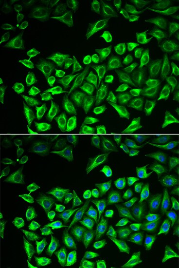 Hyaluronan Synthase 3/HAS3 Antibody