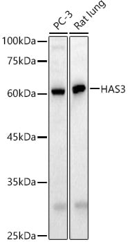 Hyaluronan Synthase 3/HAS3 Antibody
