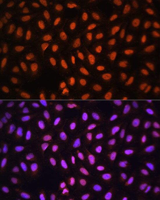 MCM5 Antibody