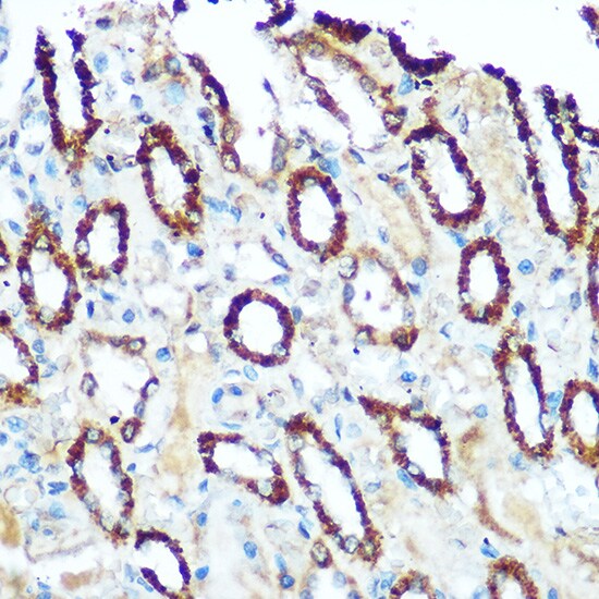 Ndufs4 Antibody