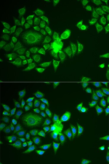 Ndufs4 Antibody