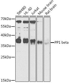 Protein Phosphatase 1 beta Antibody