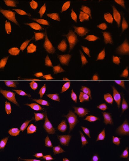 Protein Phosphatase 1 beta Antibody
