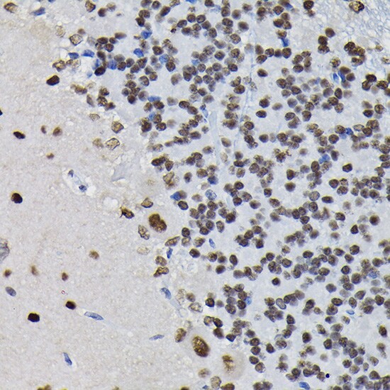 Protein Phosphatase 1 beta Antibody