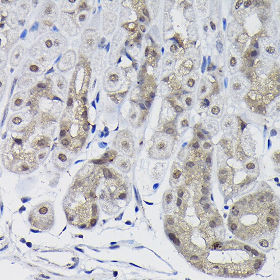 Protein Phosphatase 1 beta Antibody
